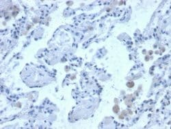 Cystatin B/Stefin B Antibody (CPTC-CSTB-3) - Azide and BSA Free, Novus
